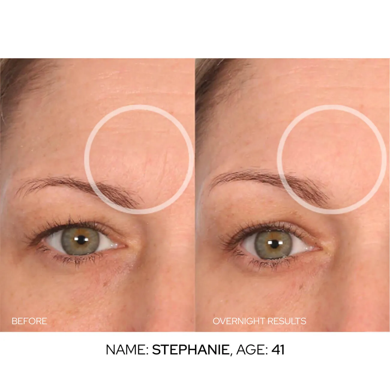BrowLift Value Packs