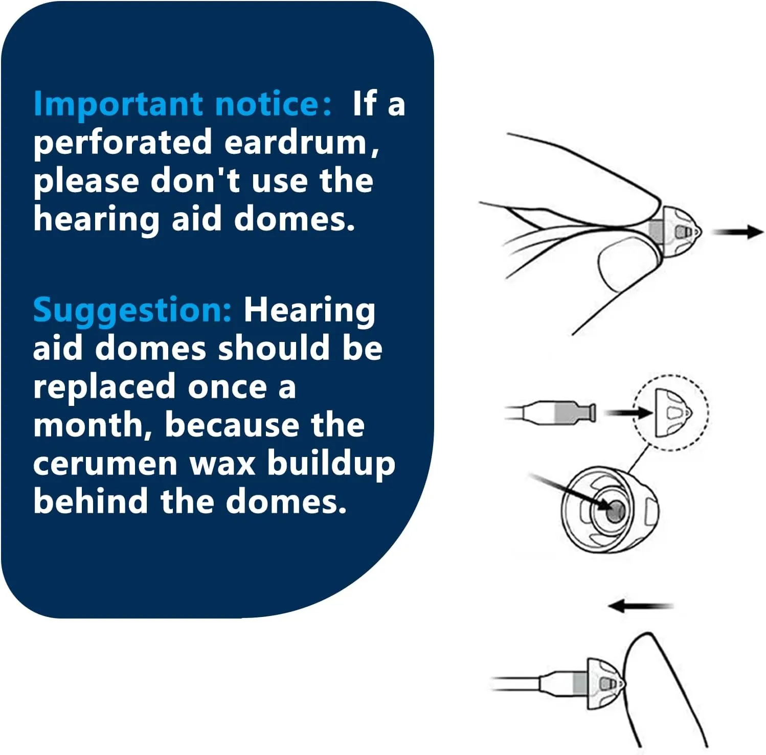 Hearing Aid Domes for Oticon Replacements, Oticon Minifit Open Vent Bass Domes (6 mm/3 Packs）, Universal Domes for Oticon Hearing Aid Supplies.