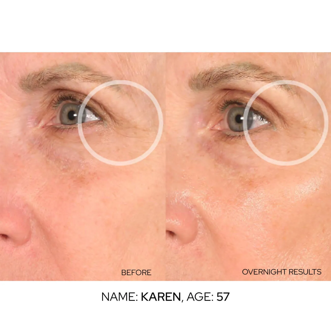 Super EyeLift Value Packs