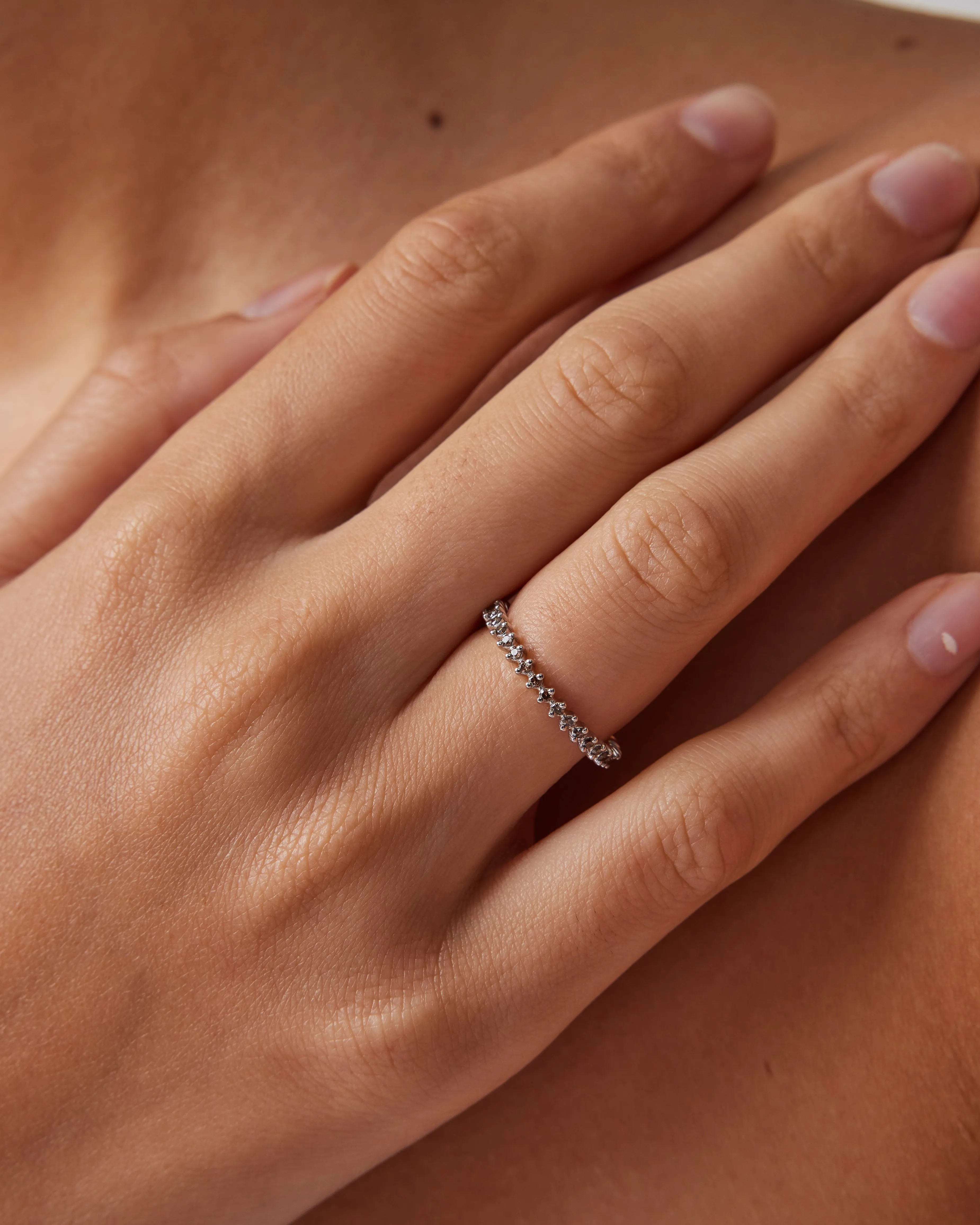 Urchin Ring